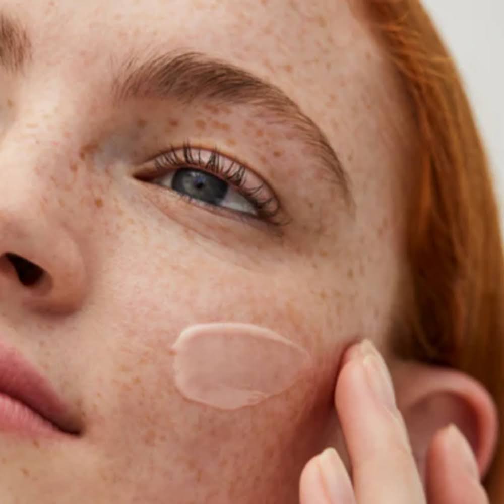 Does Niacinamide Help with Acne? Benefits and Tips 